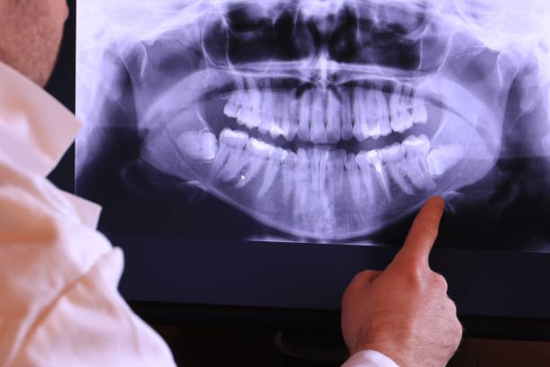 Best Emergency Dentist for Knocked-Out Tooth in La Follette, TN