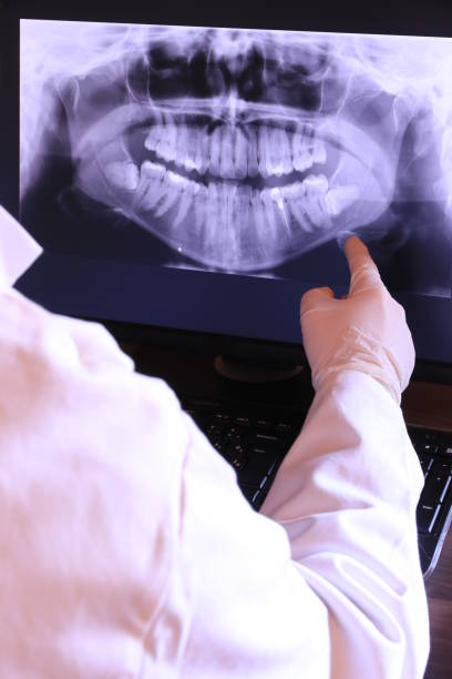 Best Emergency Dental Care for Abscessed Tooth in La Follette, TN